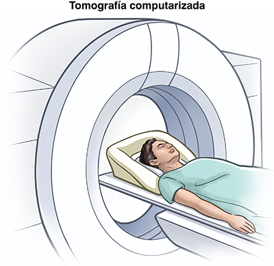 Tomografía computarizada Persona recostada en un tomógrafo.