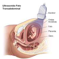 Haga clic sobre la imagen para ampliar Ilustración de una ecografía fetal transabdominal