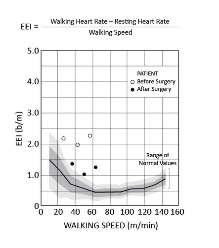 energy expenditure